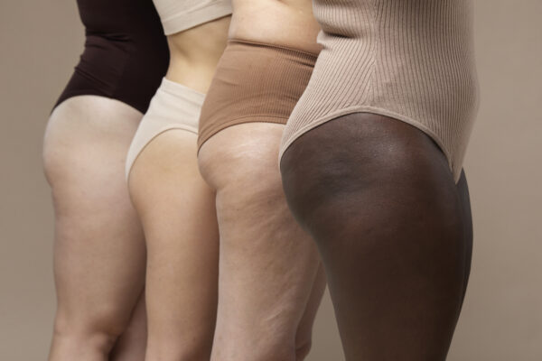 Diverse women showcasing body positivity.